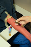 Sondevoeding toedienen